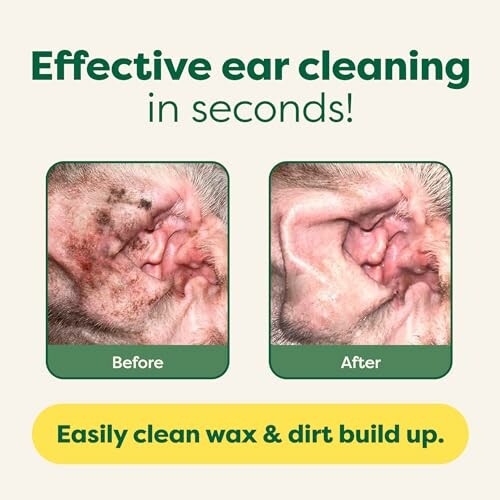 Before and after images showing effective ear cleaning results.